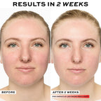 Ouraskin Wireless 7-in-1 LED Face Mask Pro